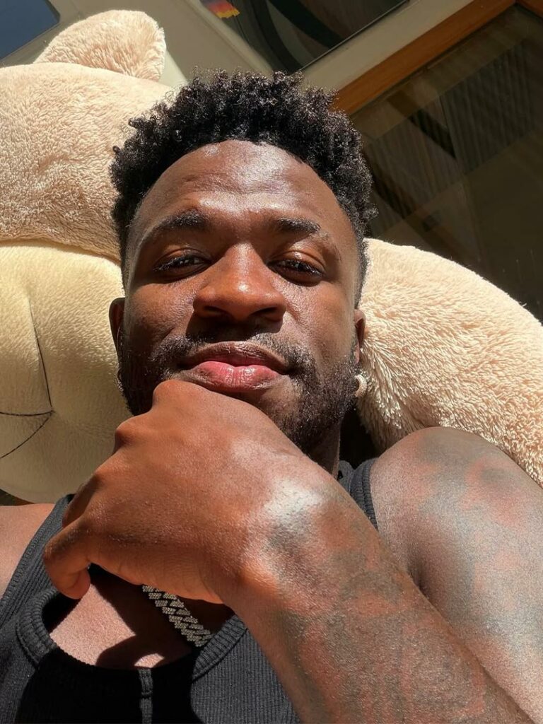 Vinícius Jr muestra su transformación de armonización facial